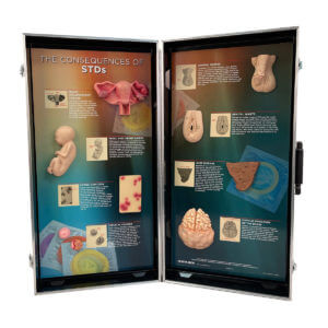 The Consequences of STDs 3-D Display