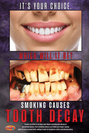 Tooth Decay Poster