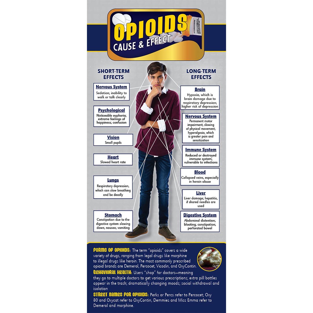 Cause & Effect Rack Cards: Opioids