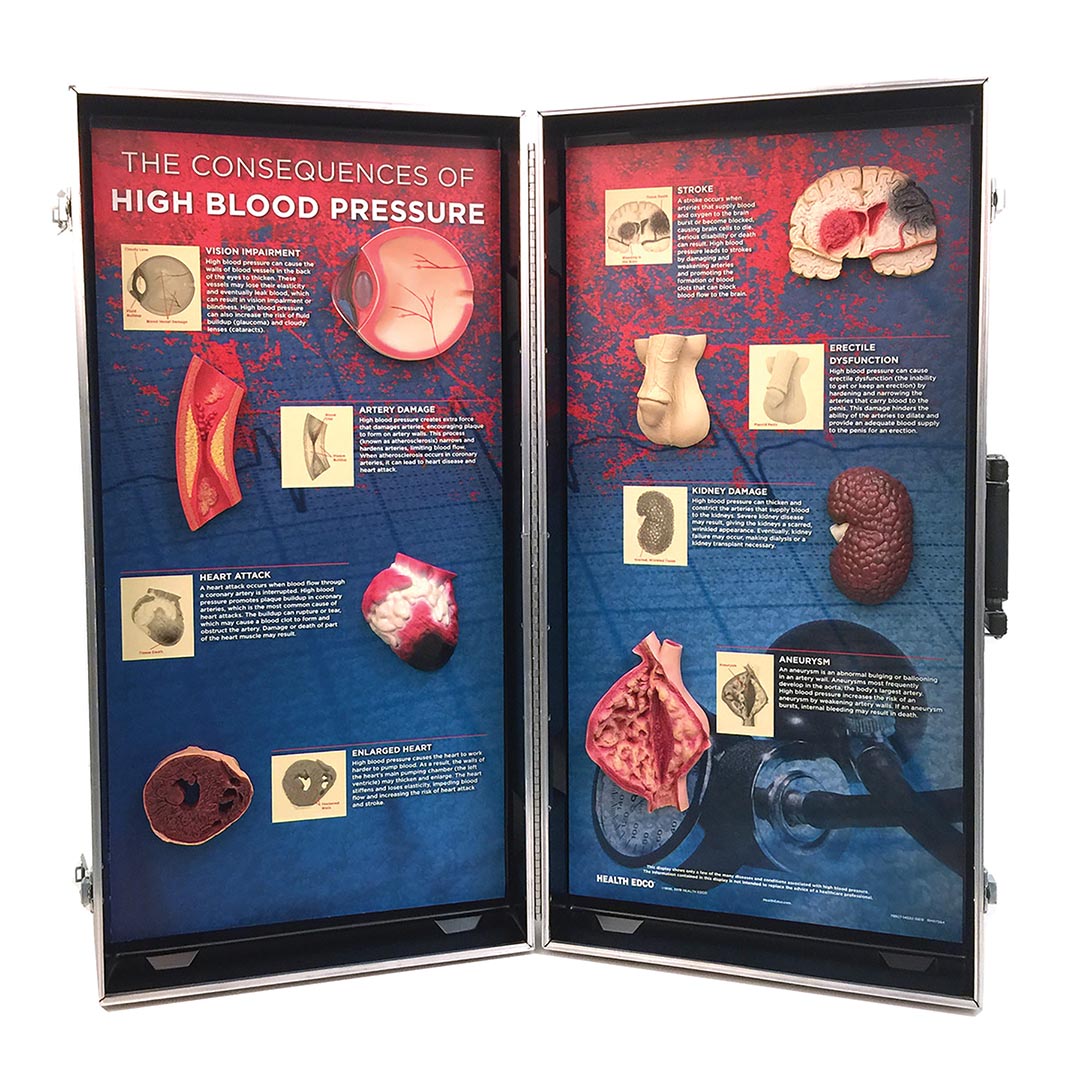 Displays