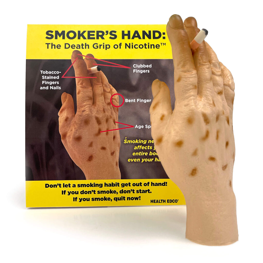 Smoker’s Hand: The Death Grip Of Nicotine Model