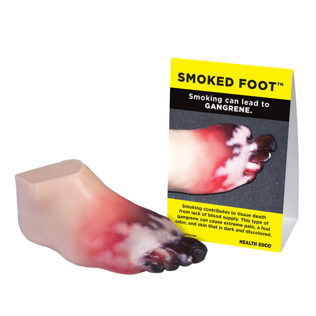 Smoked Foot Gangrene Model
