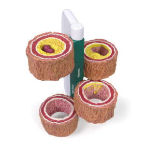 4 Piece Artery Model