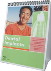 ADA Flip Guide to Dental Implants