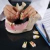 Dental Disease Model