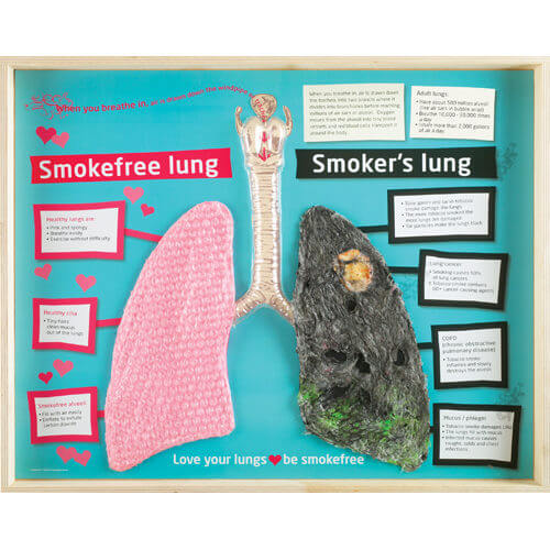 Smokefree and Smoker's Lung Display