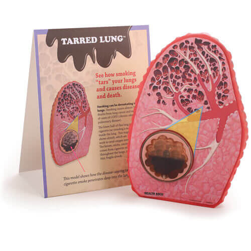 Tarred Lung Model