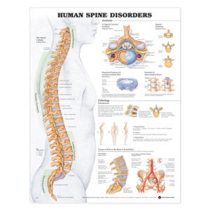 The Human Spine-Disorders