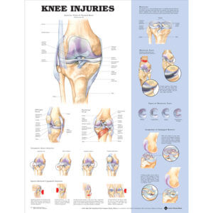 Knee Injuries Poster