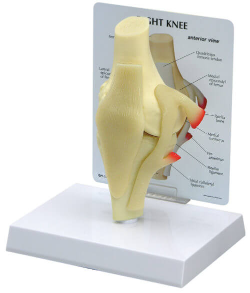 Basic Knee Model|Basic Knee Model