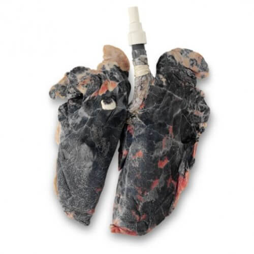 Simulated Smoker's Lungs (No Accessories) 2