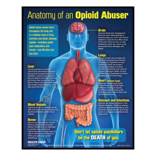 Anatomy Of An Opioid Abuser 3-D Display 3