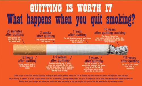 Quitting Is Worth It 3' x 5' Banner 1