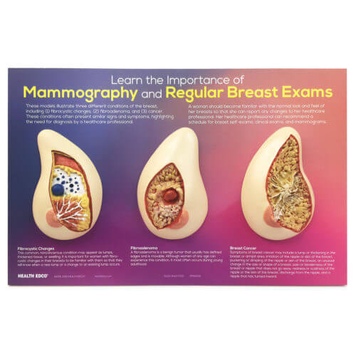 Learn the Importance of Mammography Display