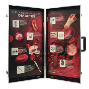 Diabetes Consequences 3-D Display