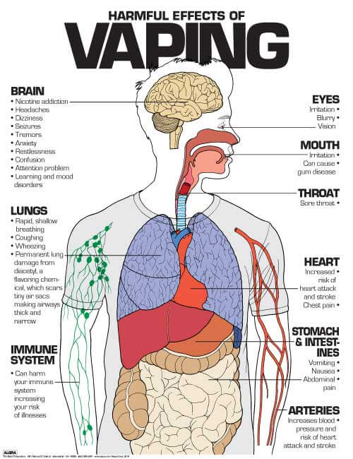 1000 word essay on why vaping is bad