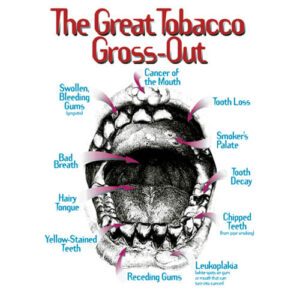 Great Tobacco Gross-Out Poster