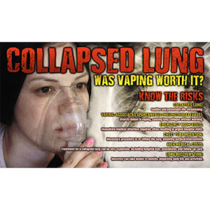 Vaping Prevention Banner: Collapsed Lung – Was Vaping Worth It?