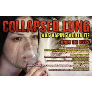 Vaping Prevention Poster – Collapsed Lung – Was Vaping Worth It?