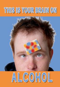 This is Your Brain on Alcohol – DVD This is Your Brain on Alcohol – DVD