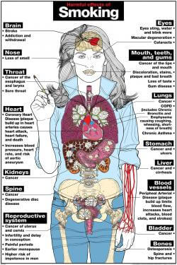 Smoking Poster
