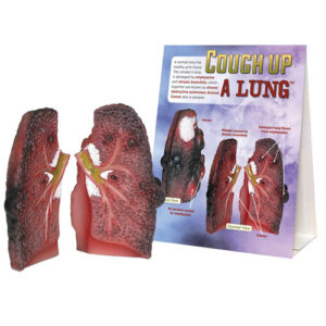 Cough Up A Lung Model