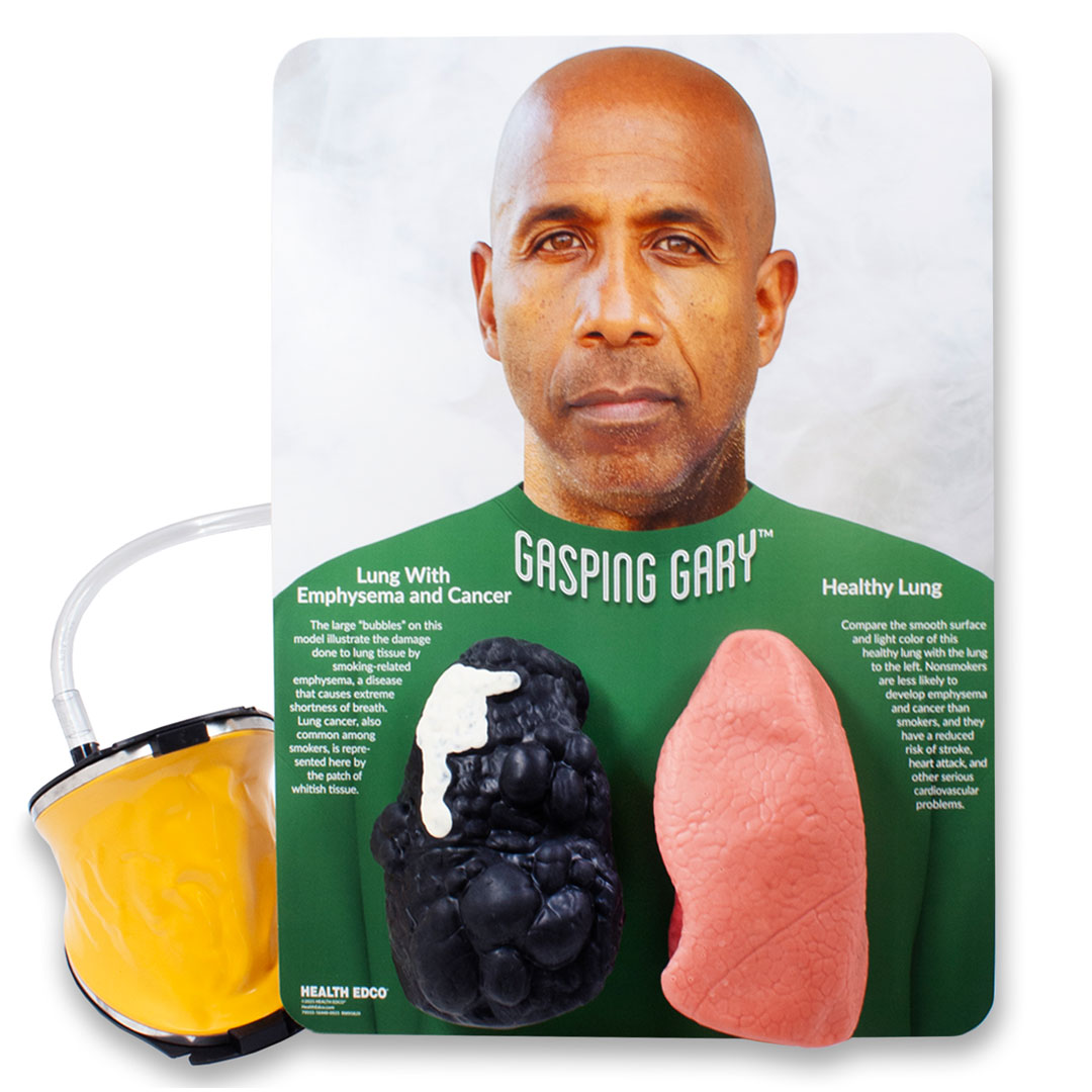Gasping Gary™ Smoker’s Lungs Comparison Model
