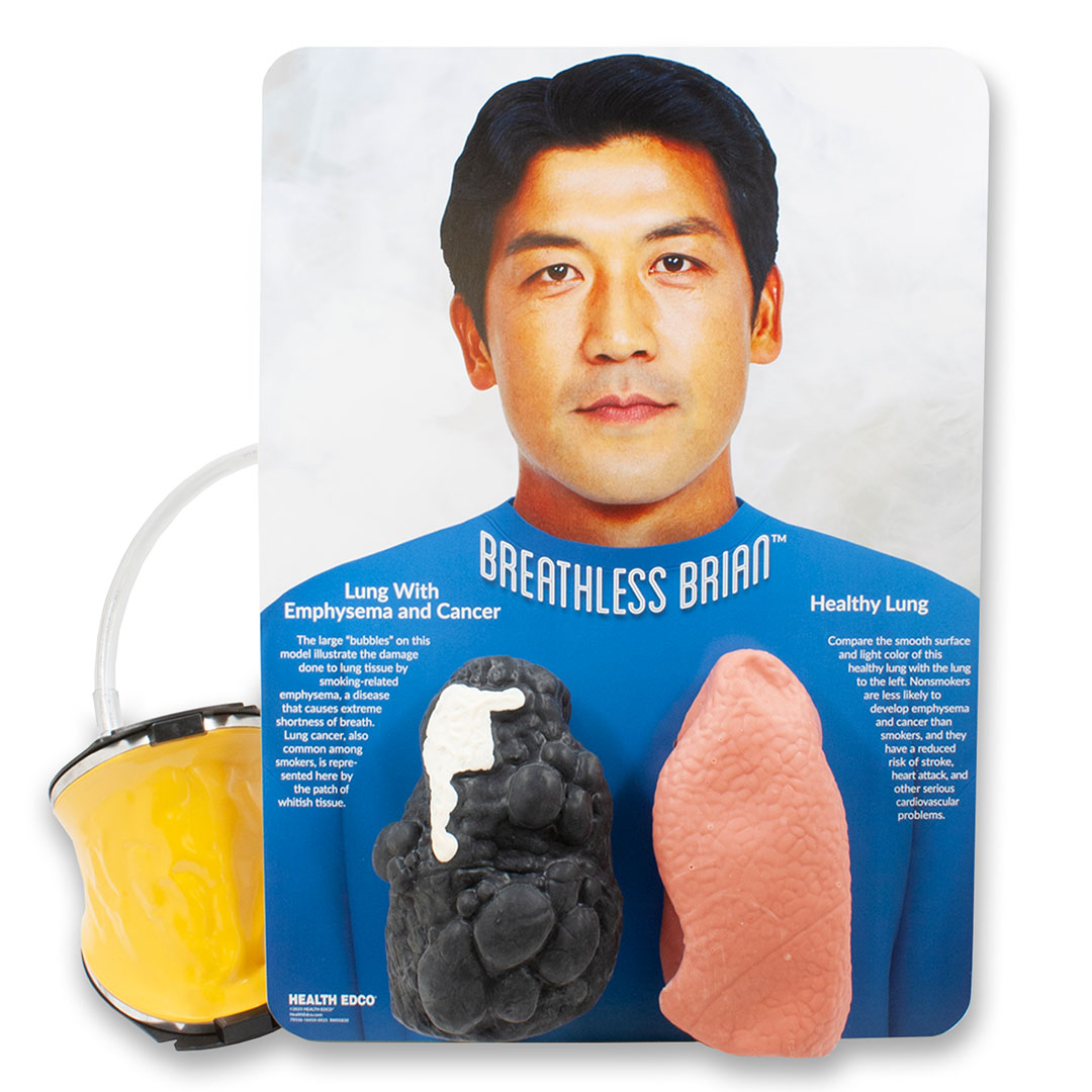 Breathless Brian™ Smoker’s Lungs Comparison Model