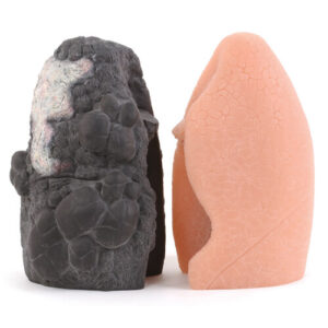 LIFE OR DEATH LUNGS DISPLAY