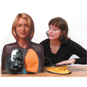 Lou-Wheeze™ Smoker’s Lungs Comparison Model