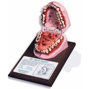 Mr. Gross Mouth Display