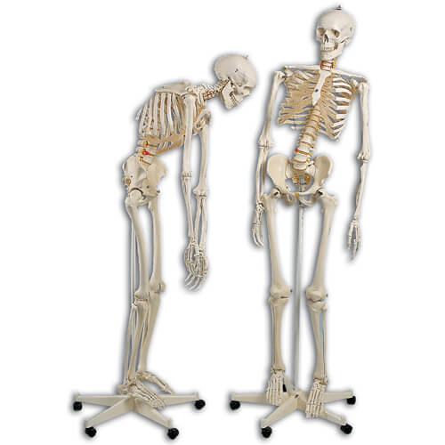 Fred the Flexible Skeleton Fred the Flexible Skeleton