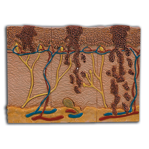 Skin Cancer Model Skin Cancer Model