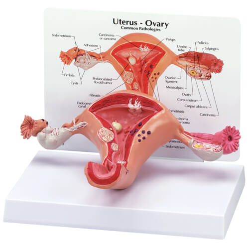 Uterus Model Uterus Model
