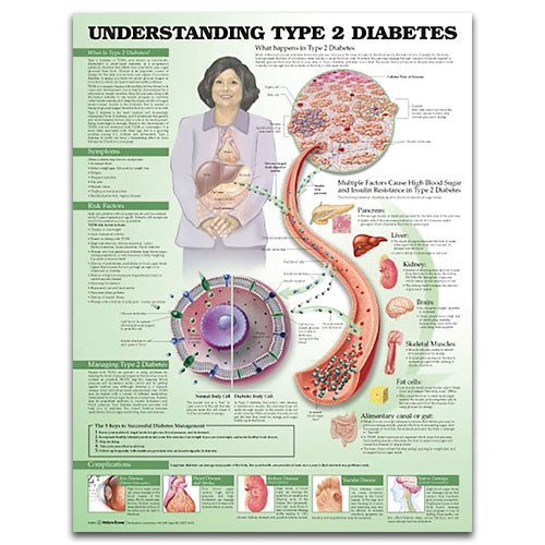 Understanding Type 2 Diabetes Understanding Type 2 Diabetes
