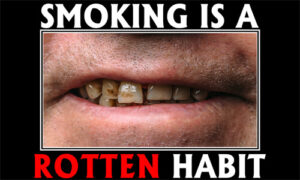 Tobacco Prevention Banner (Customizable): Smoking Is A Rotten Habit