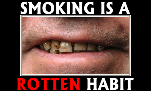 Tobacco Prevention Banner (Customizable): Smoking Is A Rotten Habit Tobacco Prevention Banner (Customizable): Smoking Is A Rotten Habit