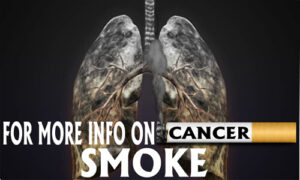 Tobacco Prevention Banner (Customizable): For More Info On Cancer…