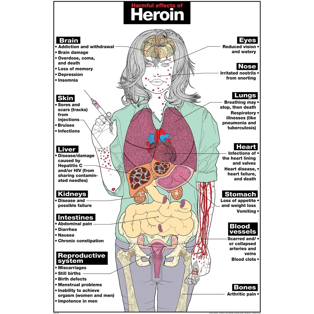Heroin Poster