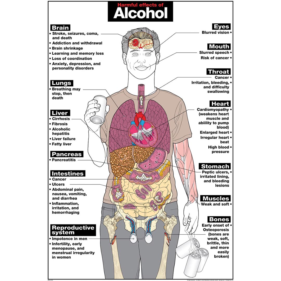 Effects of Alcohol Poster