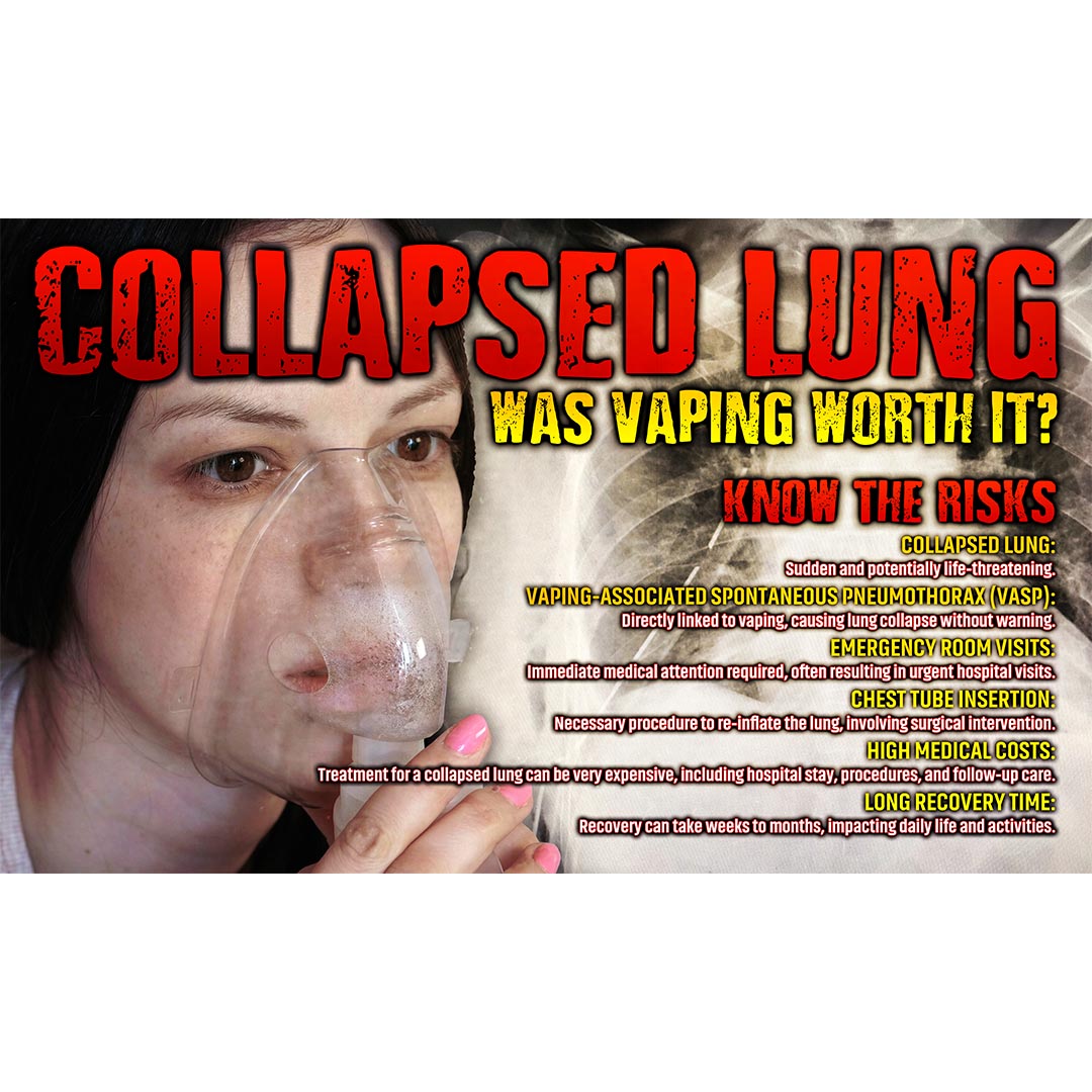 Vaping Prevention Banner: Collapsed Lung – Was Vaping Worth It?