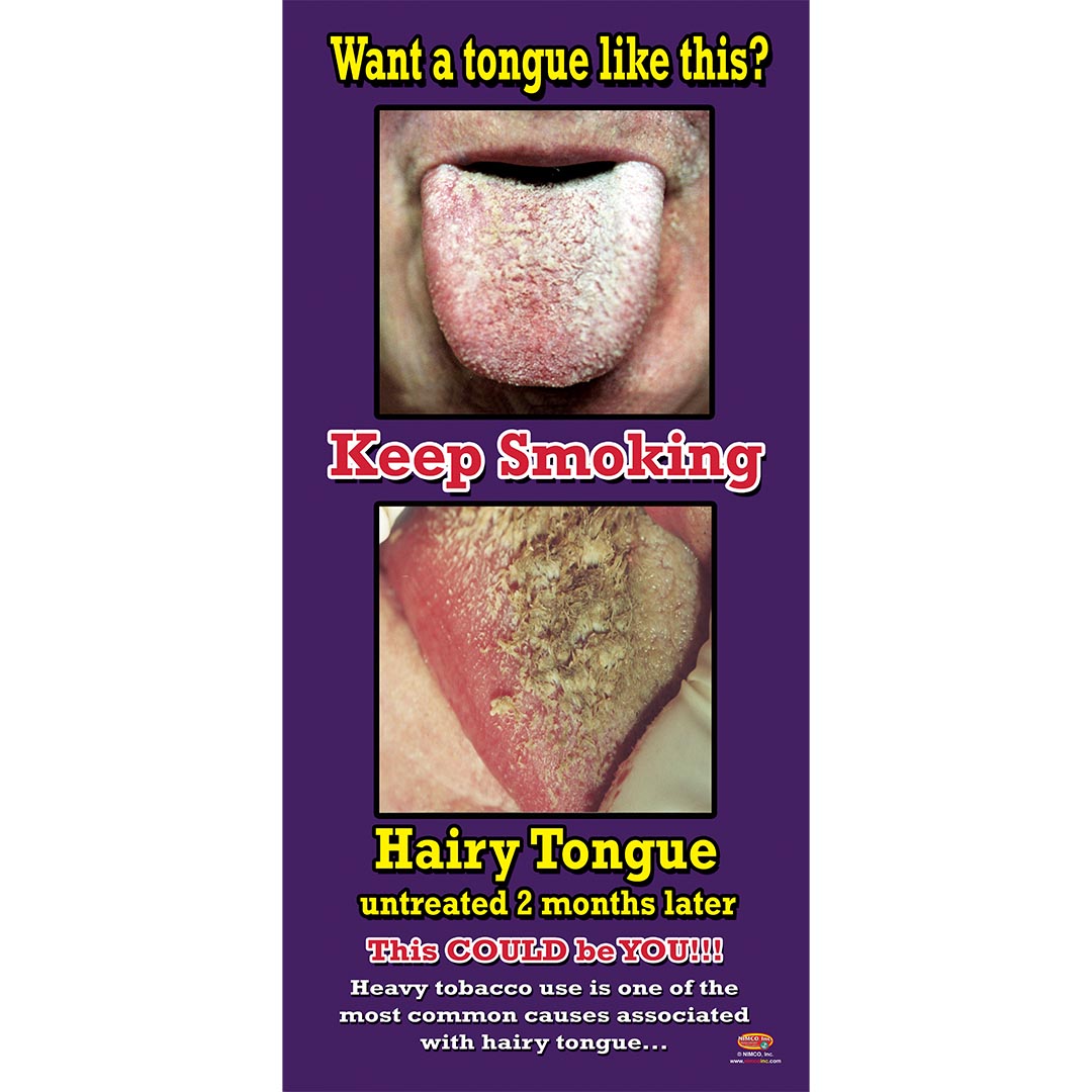 Hairy Tongue Poster